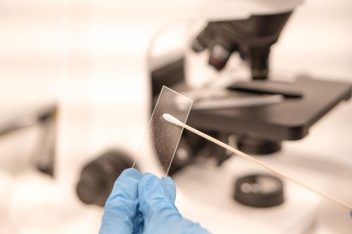 Abstrich bei einer Krebsvorsorgeuntersuchung. Im Hintergrund ein Mikroskop